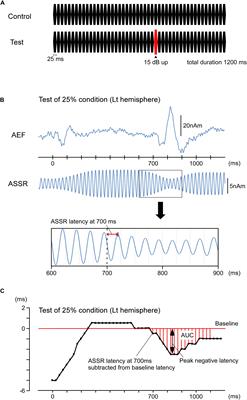 Change-Related Acceleration Effects on Auditory Steady State Response